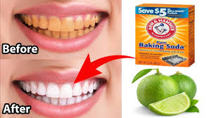 Memutihkan Gigi Dengan Baking Soda dan Lemon Memutihkan Gigi Dengan Baking Soda dan Lemon