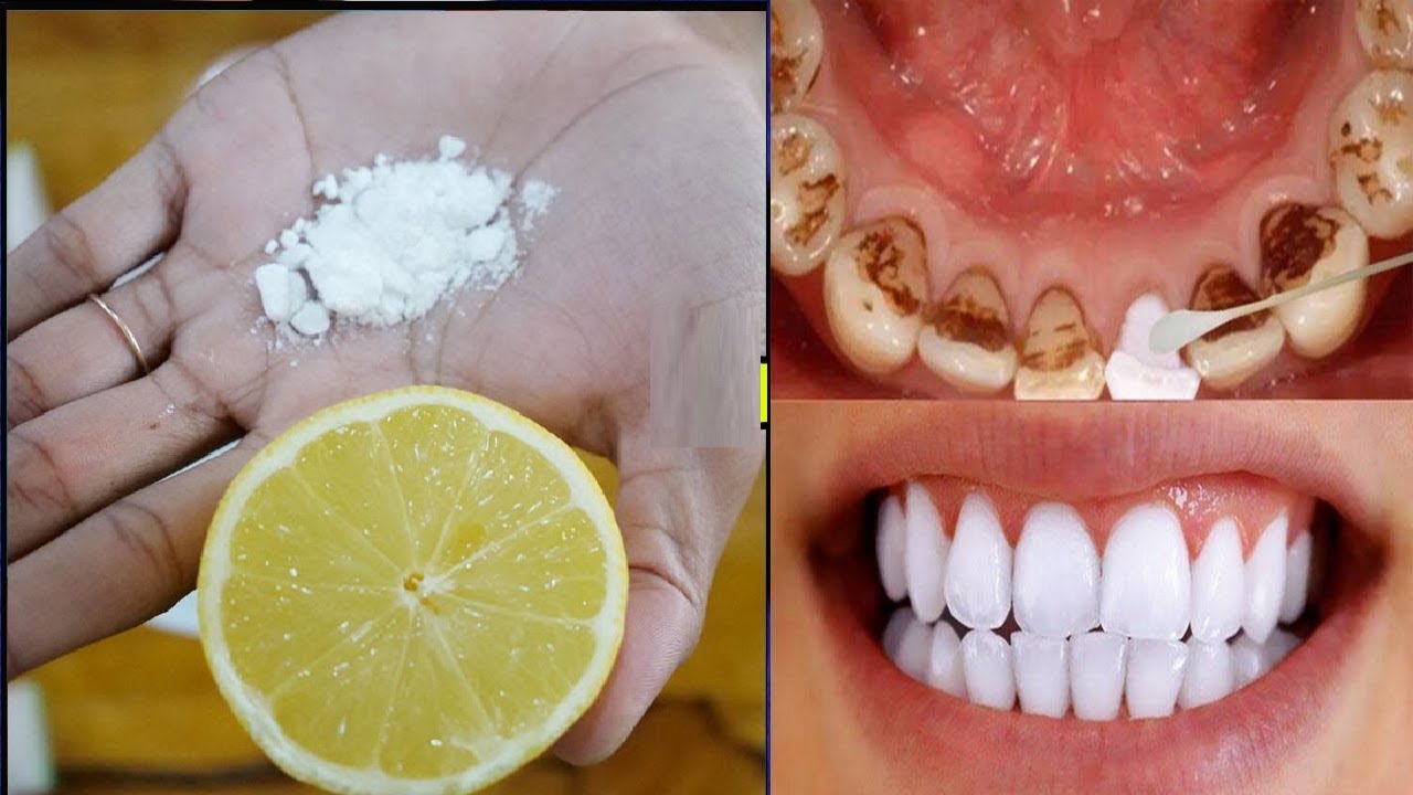 Memutihkan gigi dengan garam dan lemon Memutihkan gigi dengan garam dan lemon